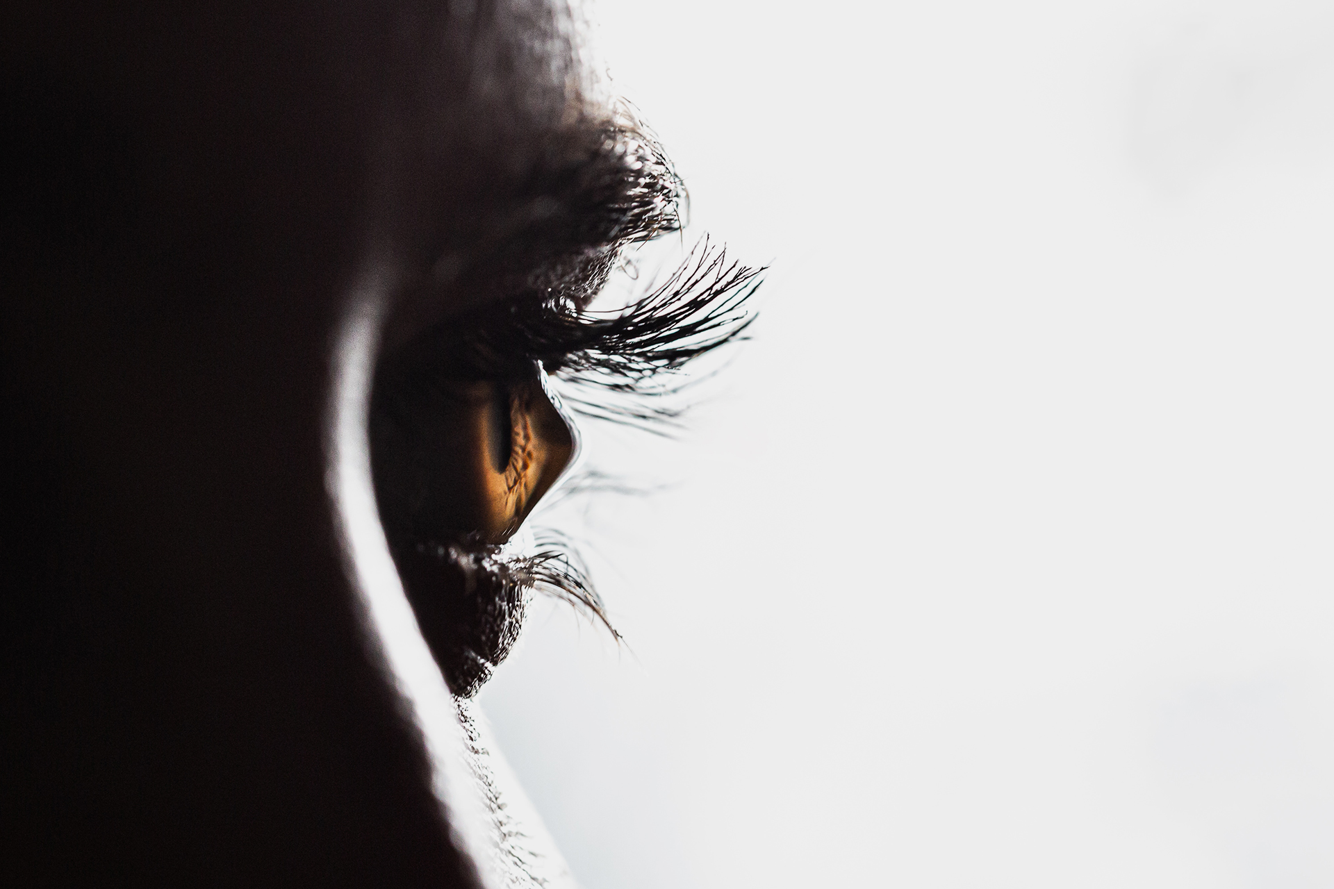 القرنية المخروطية.. فرك العينين بشكل متكرر قد يسهم في تطور المرض