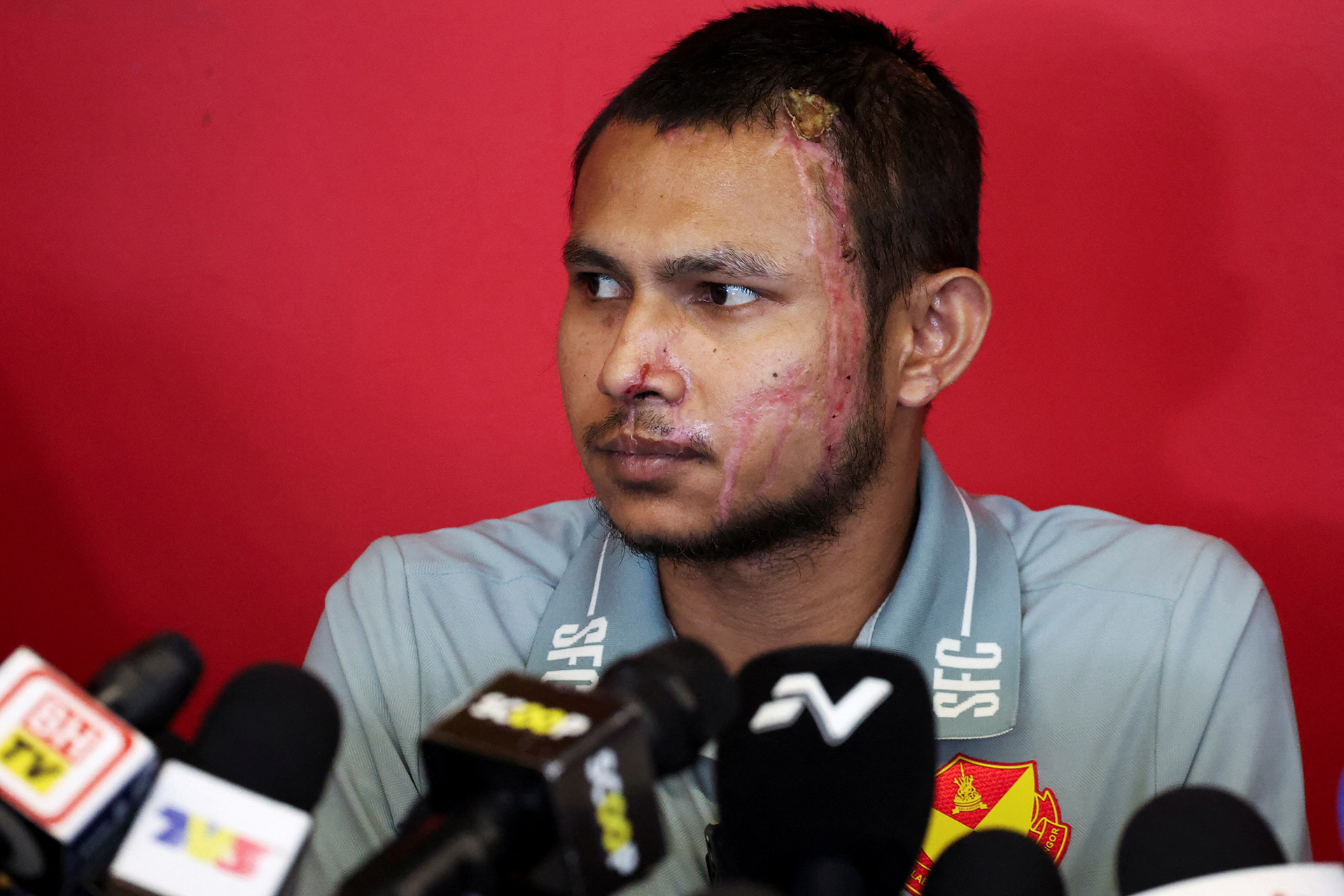 الماليزي فيصل حليم.. من ندوب الحريق إلى شجاعة لا تُقهر في كرة القدم