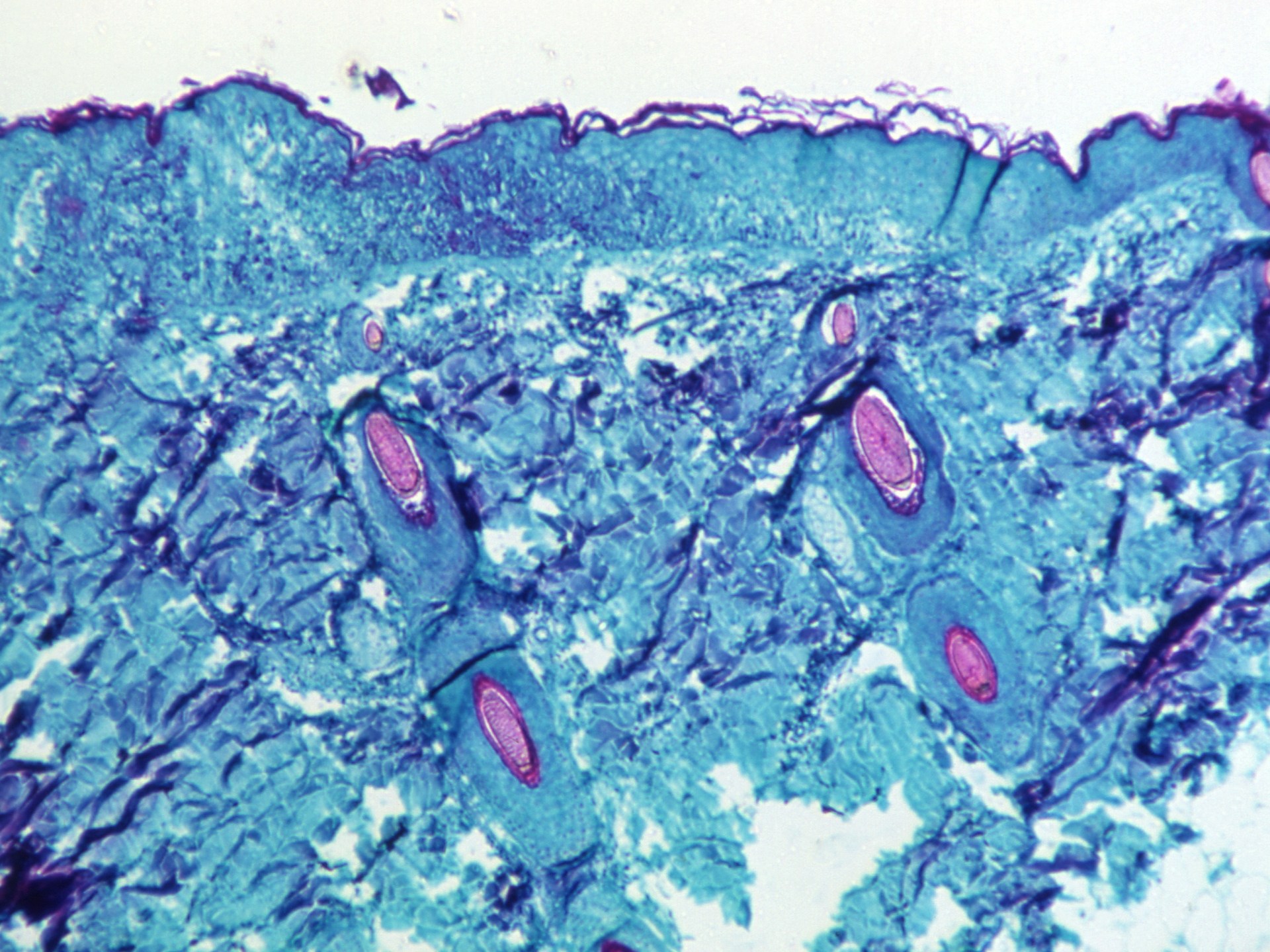 عبر اتحاد الفيزياء والذكاء الاصطناعي.. علماء يرون الأجسام الخفية في الأماكن المعتمة