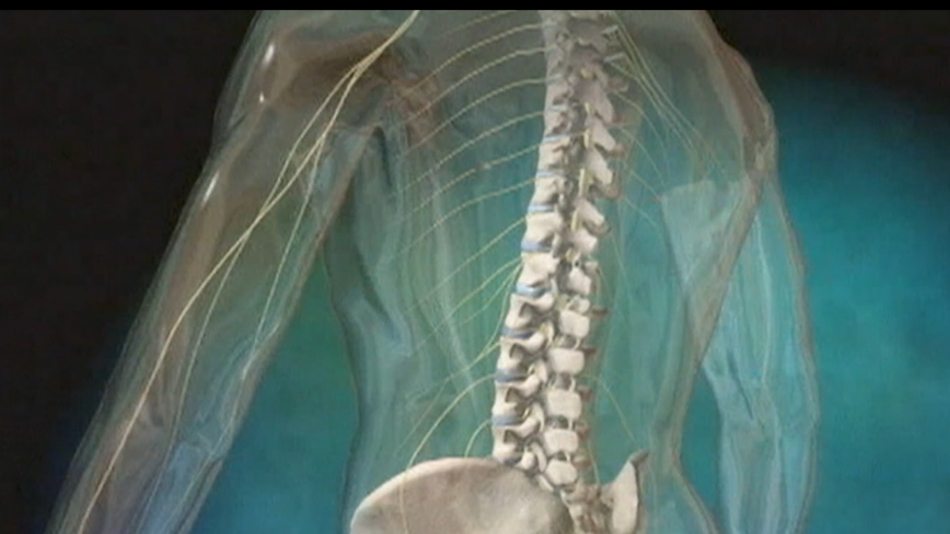 هل الحفاظ على صحة العمود الفقري مضمون مع التقدم في العمر؟