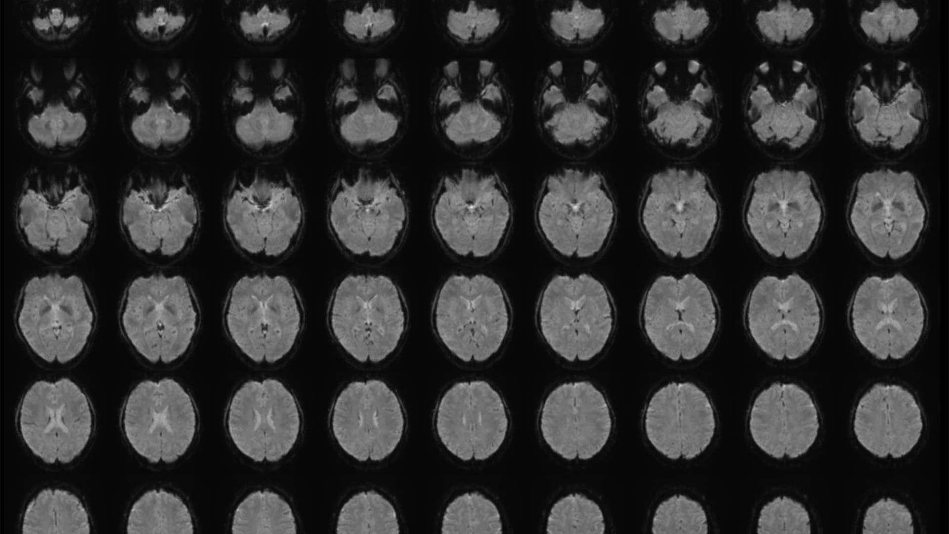 عالِم يحوّل الصور الذهنية في أدمغة البشر إلى نصوص.. كيف ذلك؟