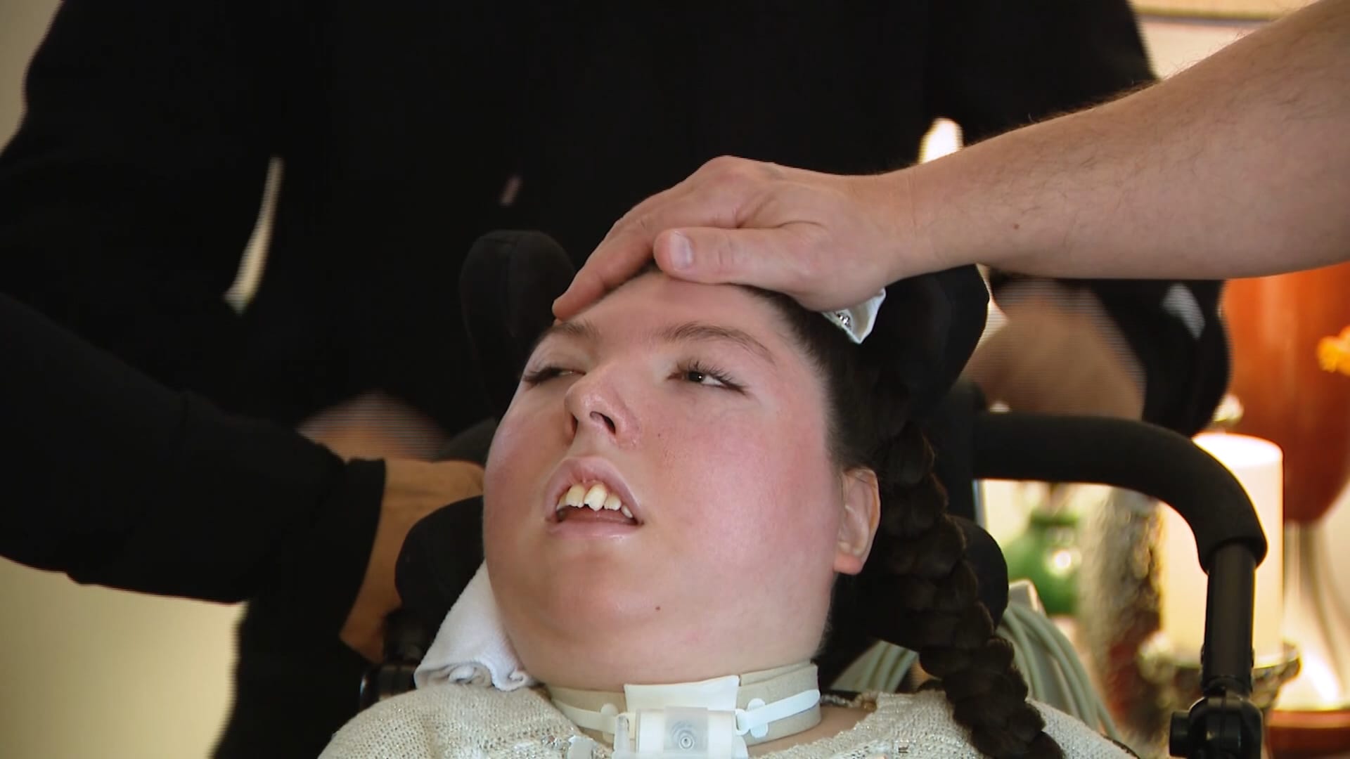 وُلدت بِلا دماغ وتوقع الأطباء ألا تعيش أكثر من أربع سنوات.. أليكس تحتفل بعامها العشرين