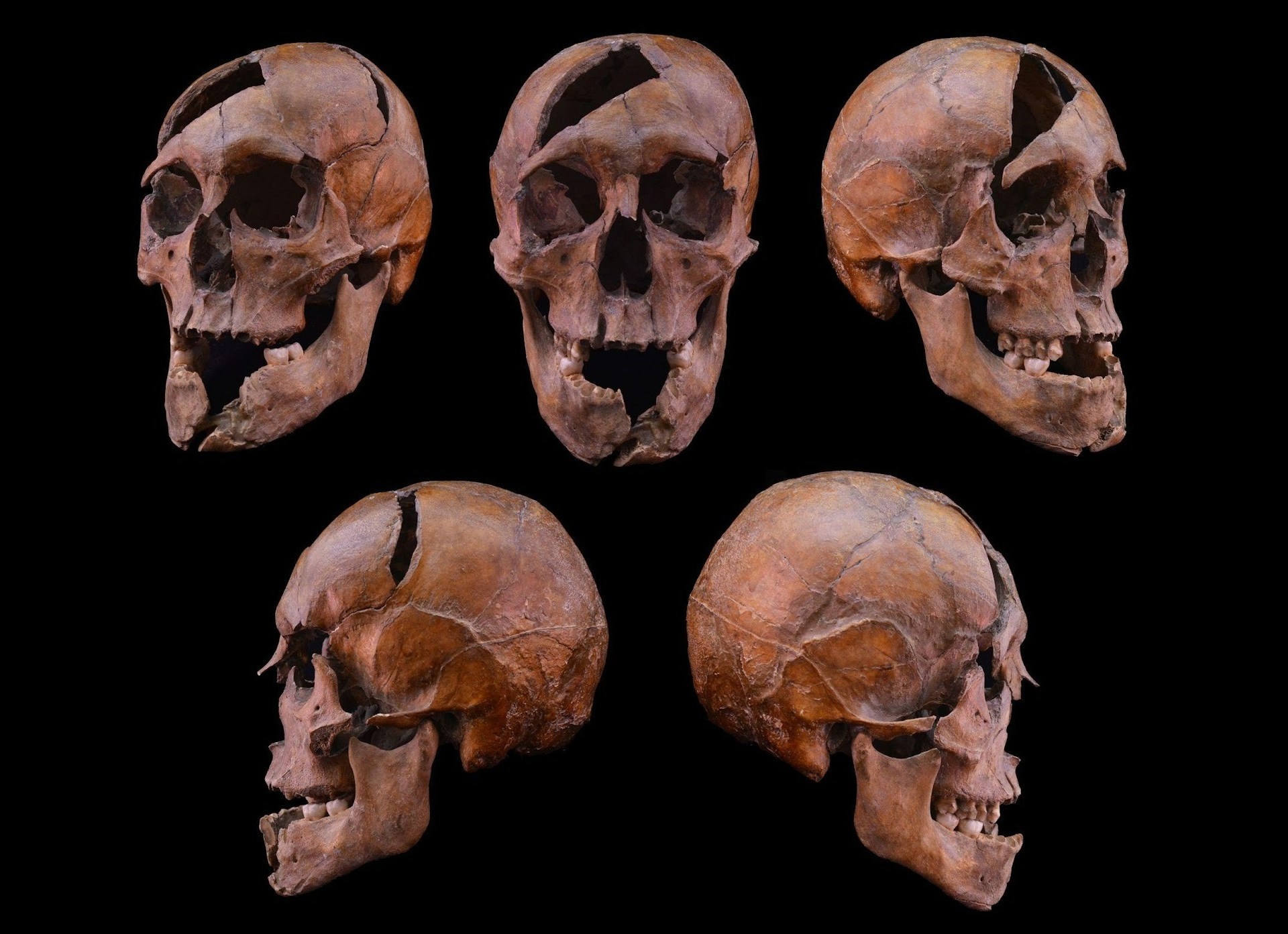 بعد 700 سنة.. العلم يحل لغز جريمة هزّت البلاط الهنغاري