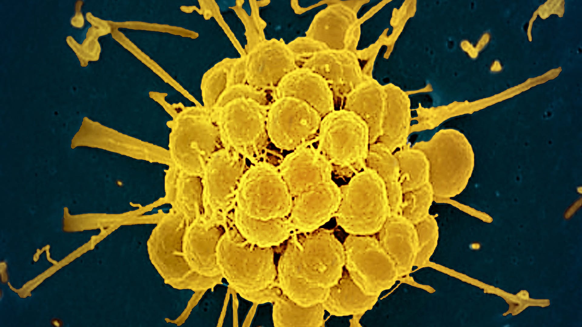 الغذاء والدواء الأمريكية توافق على مضادين حيويين جديدين لعلاج السيلان منذ عقود