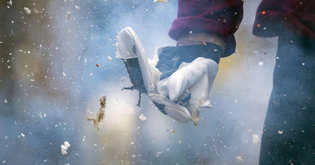 ‫الإسعافات الأولية للإصابات بالألعاب النارية