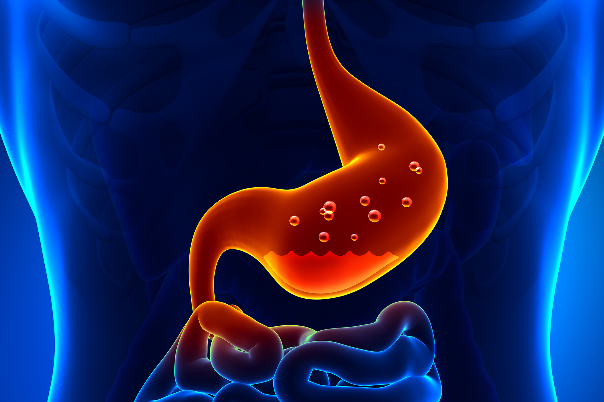 ‫ما متلازمة "مالوري-وايس"؟