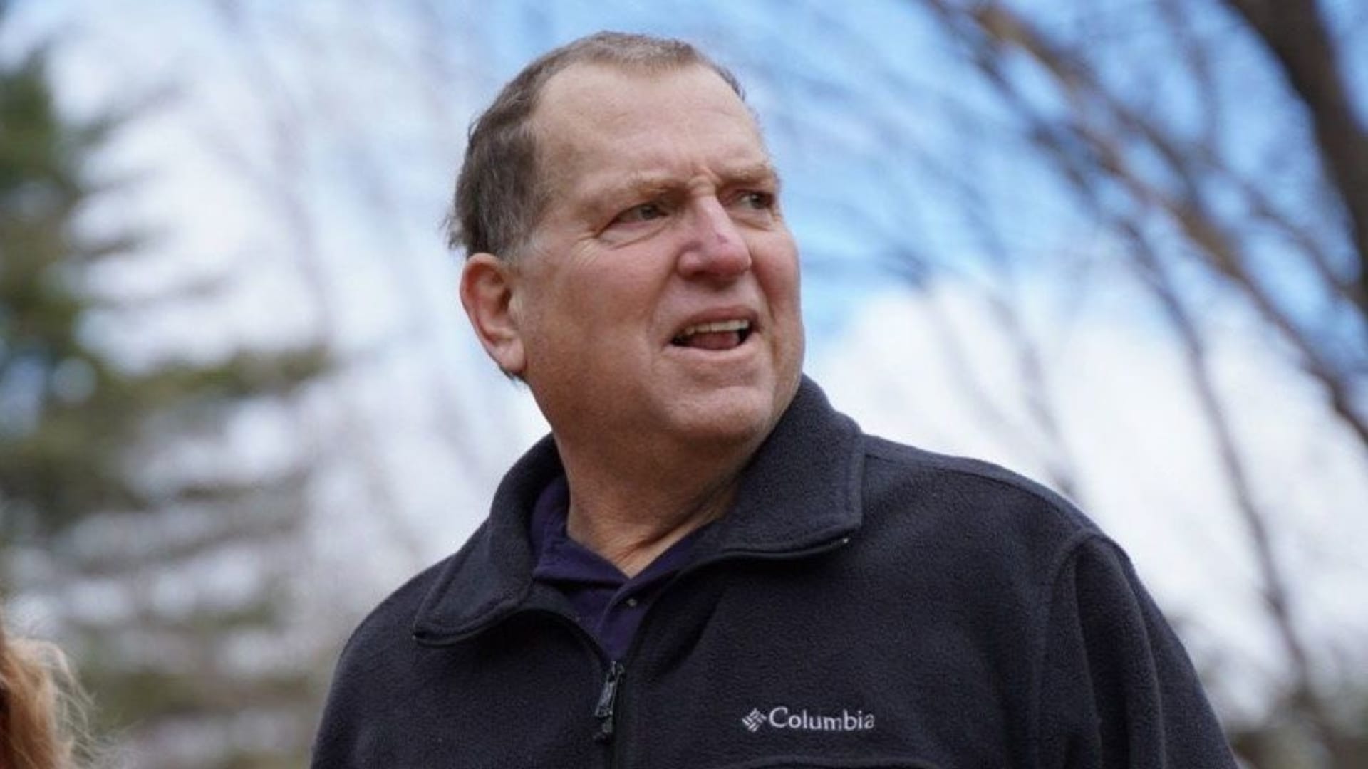 أندروز يحقق قفزة طبية: من كلية خنزير إلى حياة جديدة كأول متلقي لكلية بشرية