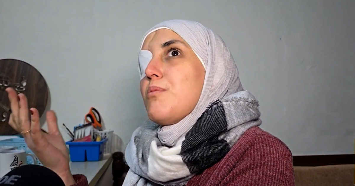 فقدت زوجها وإحدى عينيها.. سورية تحول الحرف اليدوية لشريان حياة