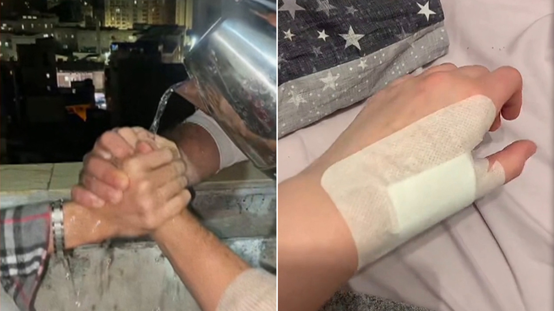 "أحرق يدي لأثبت صداقتي!".. غضب على المنصات من ترند الماء المغلي
