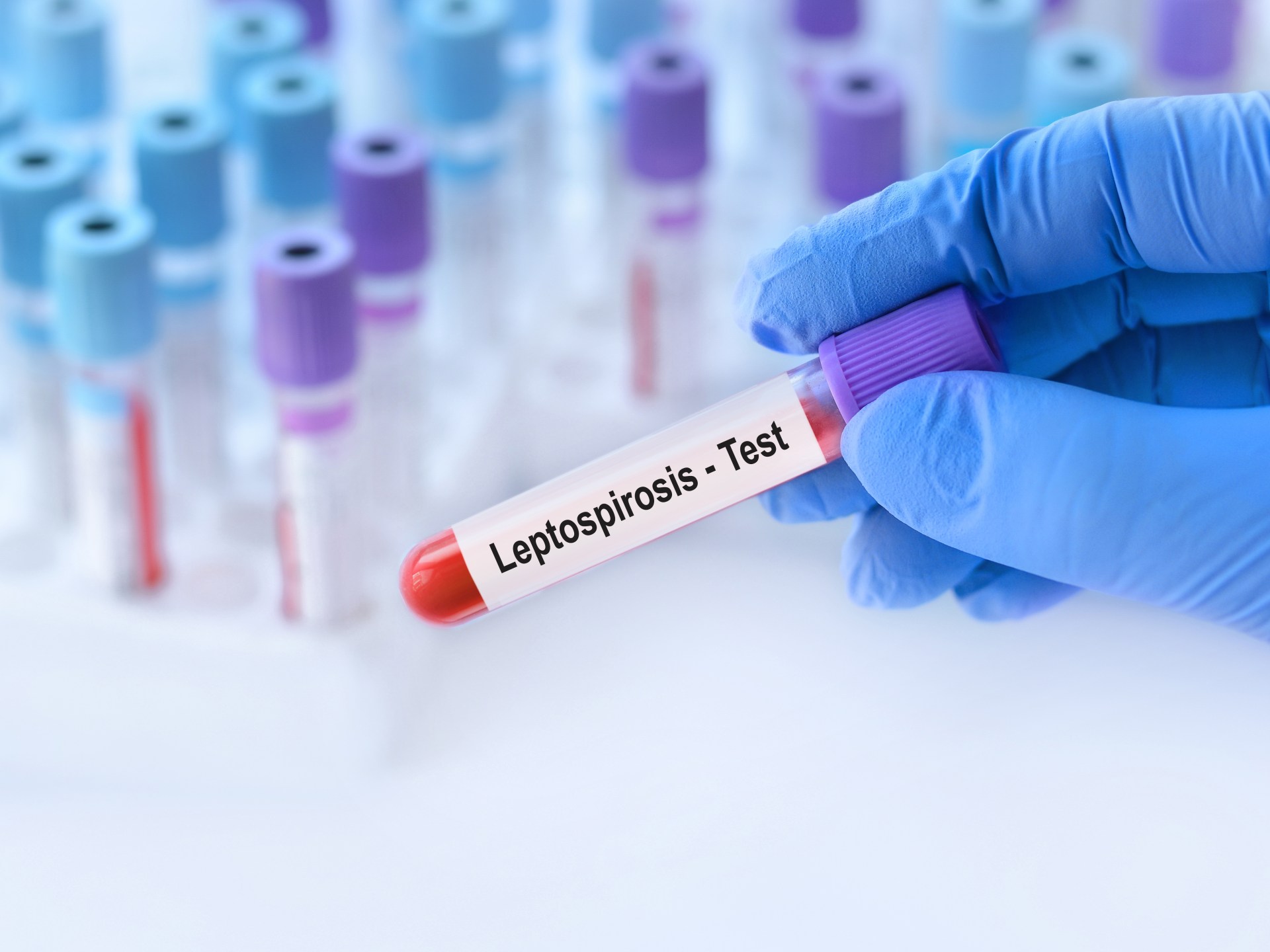 تعرف على داء البريميات