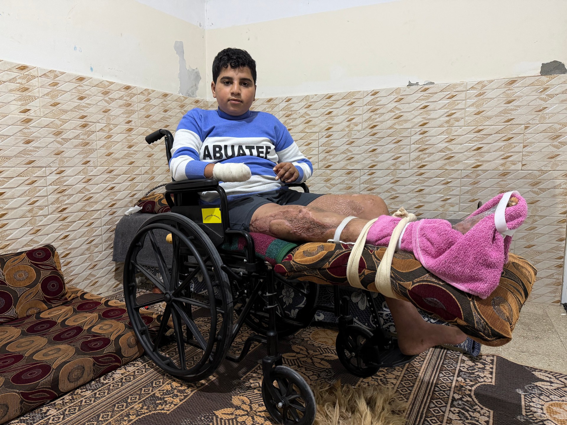 اليوم العالمي للتوعية بمخاطر الألغام.. 20 ألف قنبلة غير منفجرة في غزة