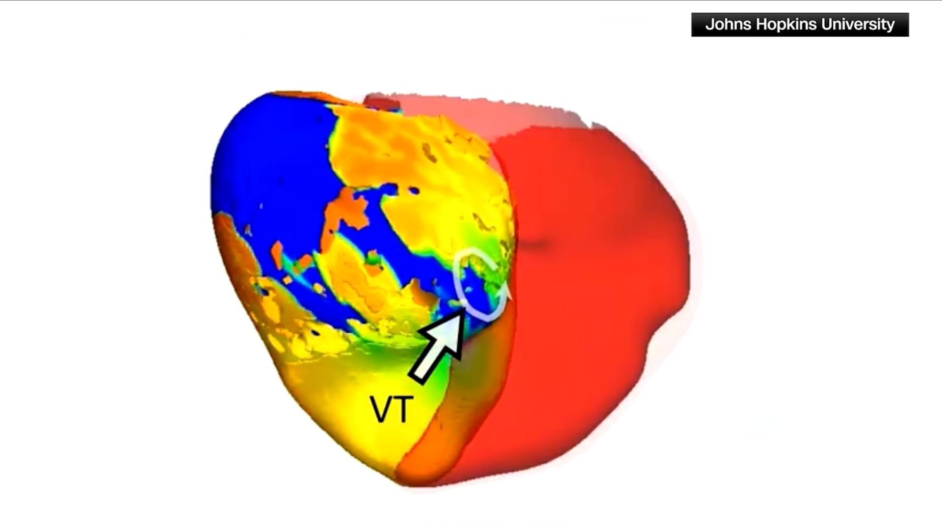 "نسخة رقمية" من قلبك على الكمبيوتر قد تنقذ حياتك.. كيف ذلك؟