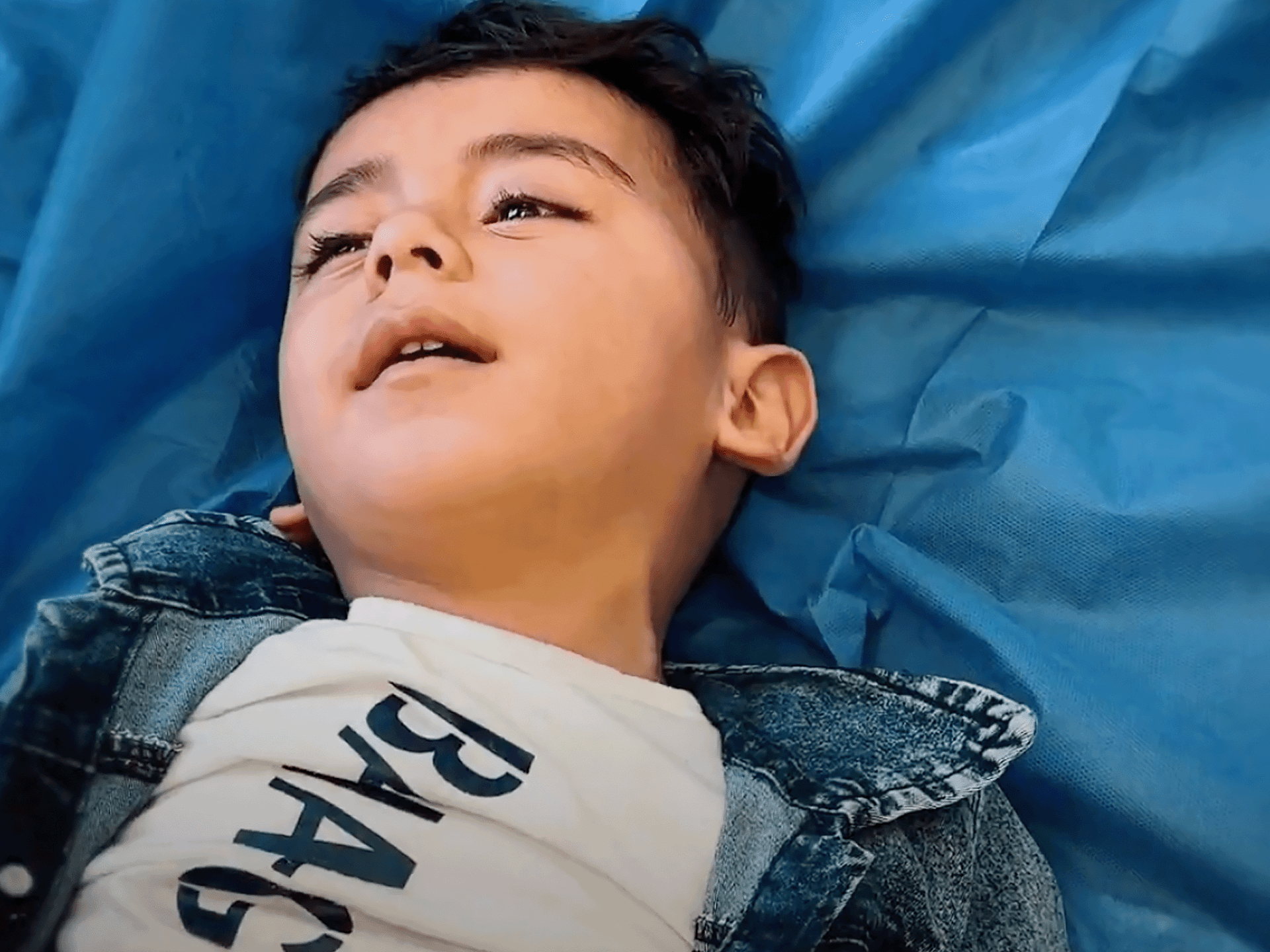 رغم انهيار القطاع الصحي.. عملية معقدة تنقذ طفلا في غزة من إعاقة دائمة