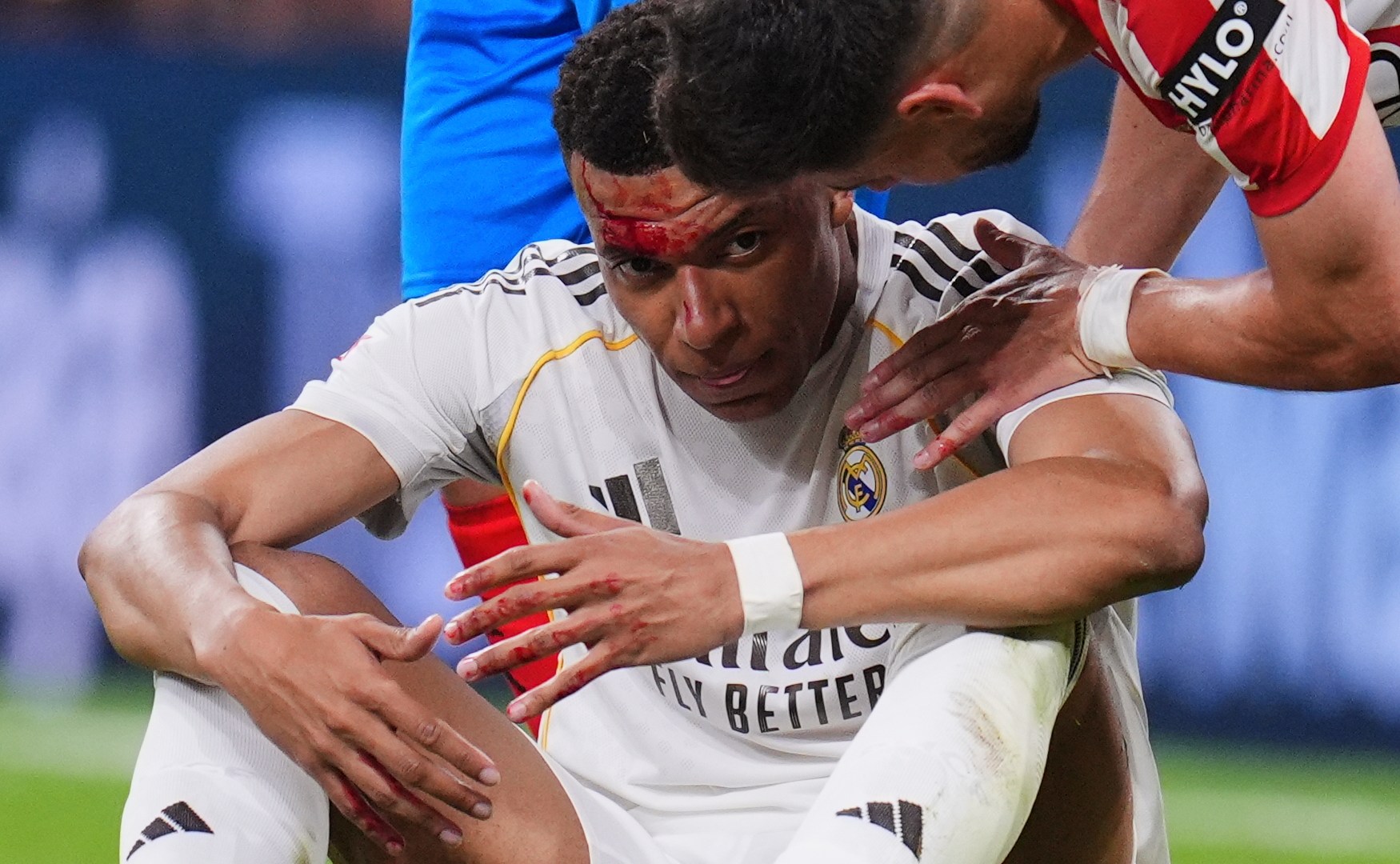 آخرها مبابي.. الضربات تتوالى على ريال مدريد قبل مواجهة بايرن ميونخ الحاسمة