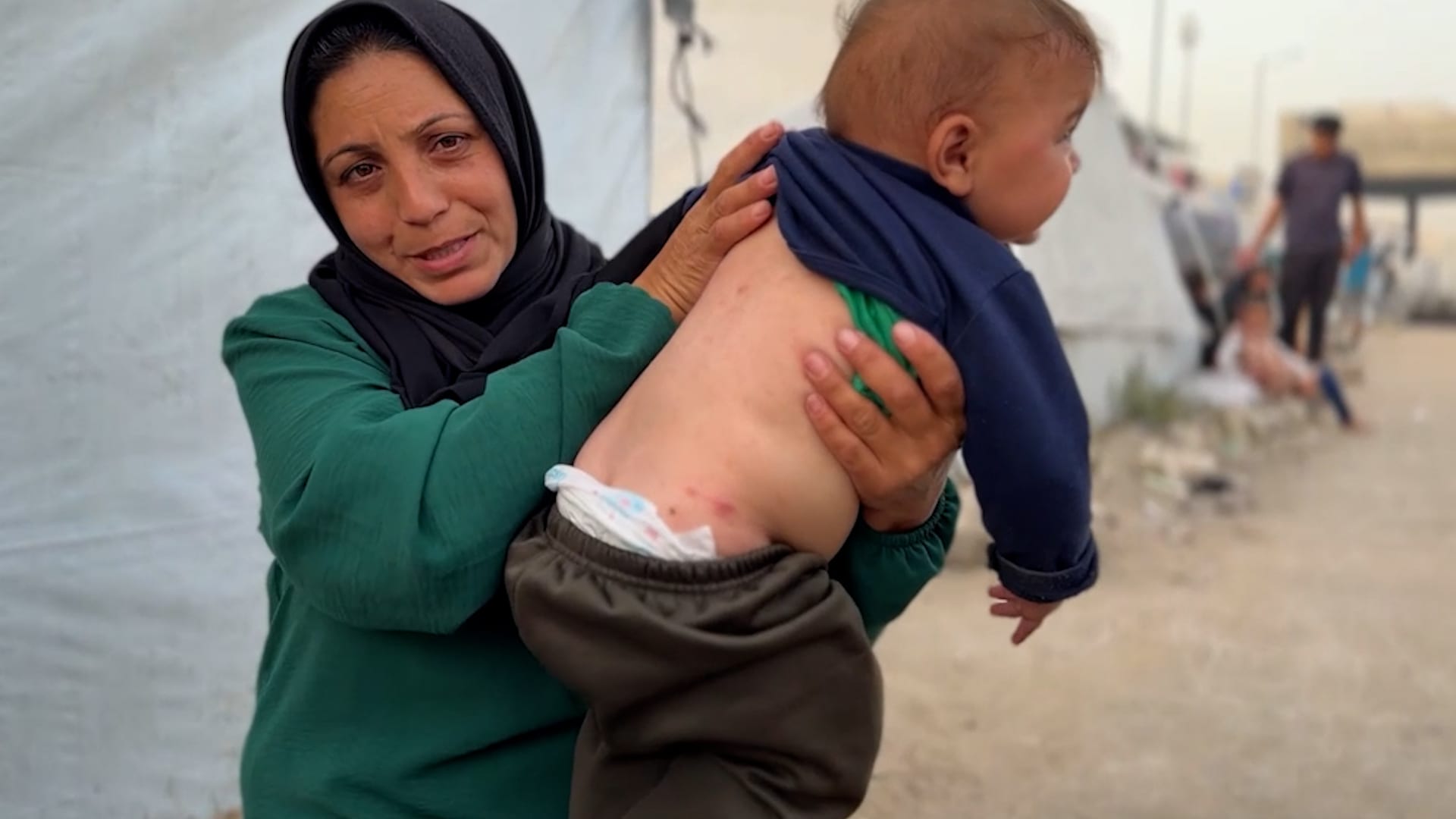 قوارض وآفات منتشرة.. أزمة صحية متفاقمة تلاحق أطفال غزة وسط تفشي الأمراض الجلدية