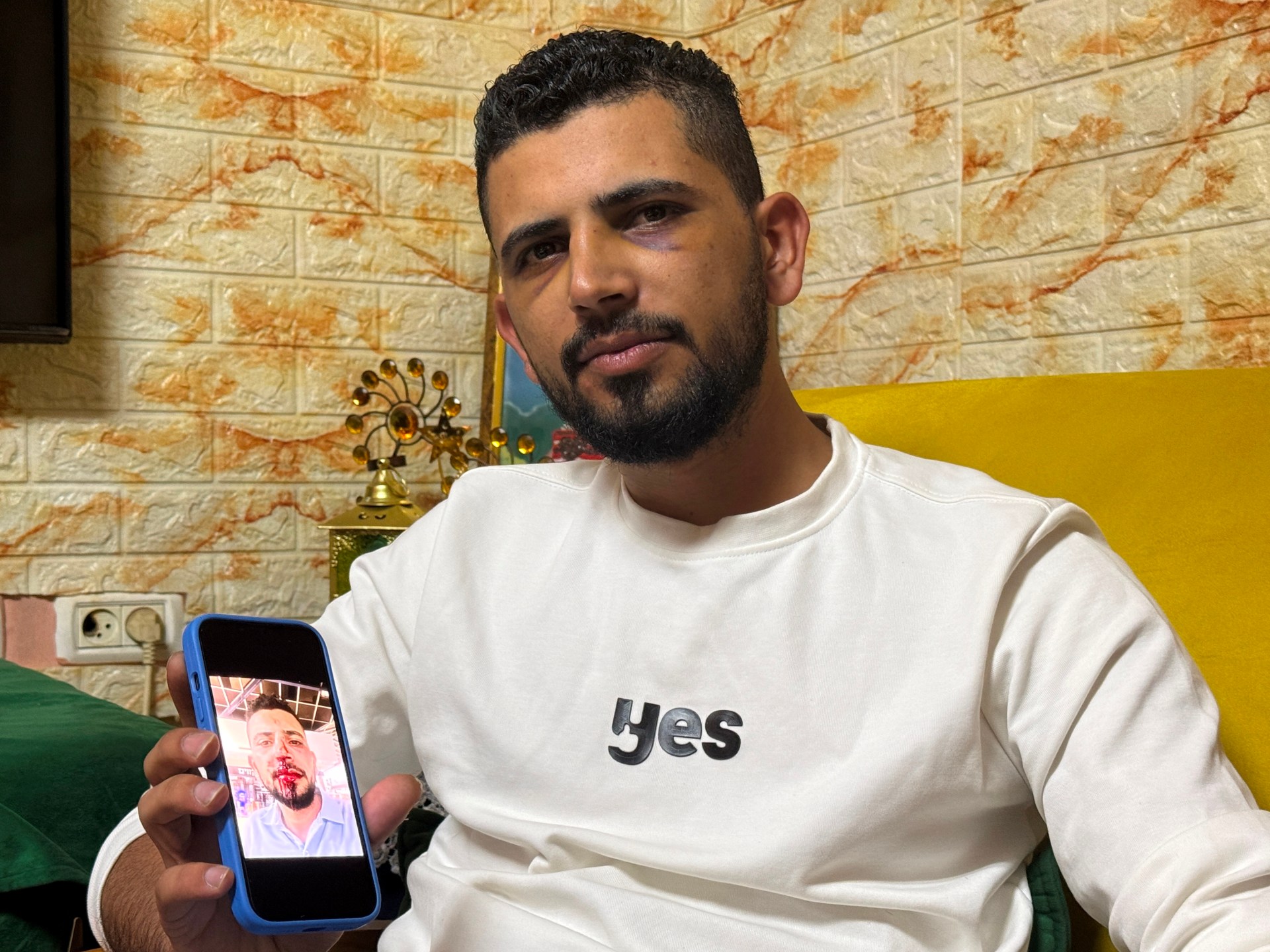 ضربوه حتى الإغماء.. سائق مقدسي ضحية اعتداء عنصري بتل أبيب