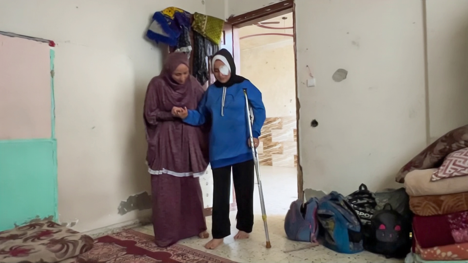 لم أعد أحب النظر إلى المرآة.. مصابون في غزة يواجهون التشوهات